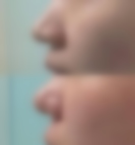 湖北十堰市妇幼保健院马晓真实案例图片,医生介绍