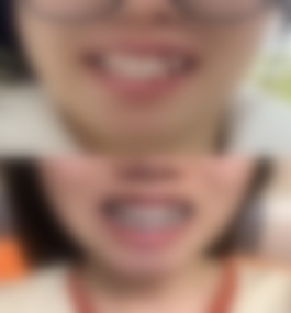 上海首尔丽格整形医院林美艳正畸真实案例以及医院介绍