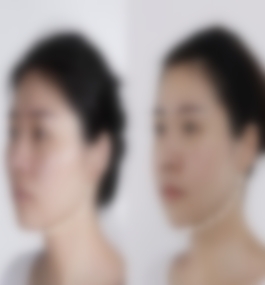 武汉中翰医院吴中兴磨骨真实案例,价格表一览？