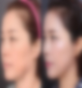 bde5f5a636b04bf2c9eb9ea0ed5e888a_副本.jpg