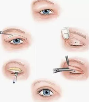 1743061519985.png 1743061519985.png